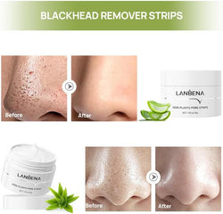 Blackhead Remover Strips, Nose Pore Strips, Blackhead Removal Mask, Peel off Mask-Deep Cleansing Pore & Acne (1.05 Ounce)